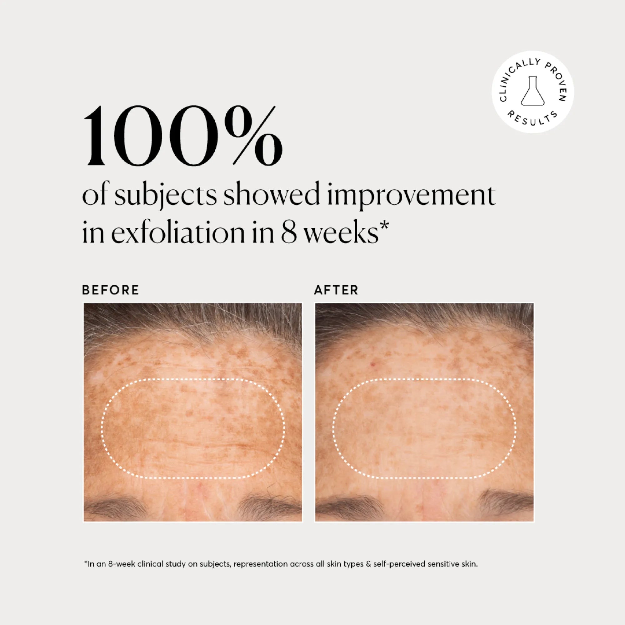 NATR-10027-Alt-Images-BHA-Liquid-Exfoliant-2_-03.jpg